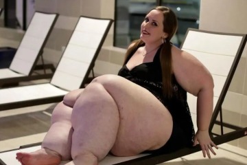 Doctors Said My Huge Legs Were 'Just Fat', But Stranger Spotted Worrying Symptoms