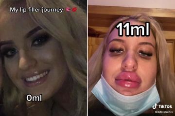 I love a juicy pout...I've gone from 0ml to 13ml over the years